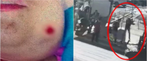 JOVEM AUTISTA É BALEADA NO ROSTO EM FRENTE À RODOVIÁRIA DE GOIÂNIA; SUSPEITO MORRE EM CONFRONTO COM A POLICIA